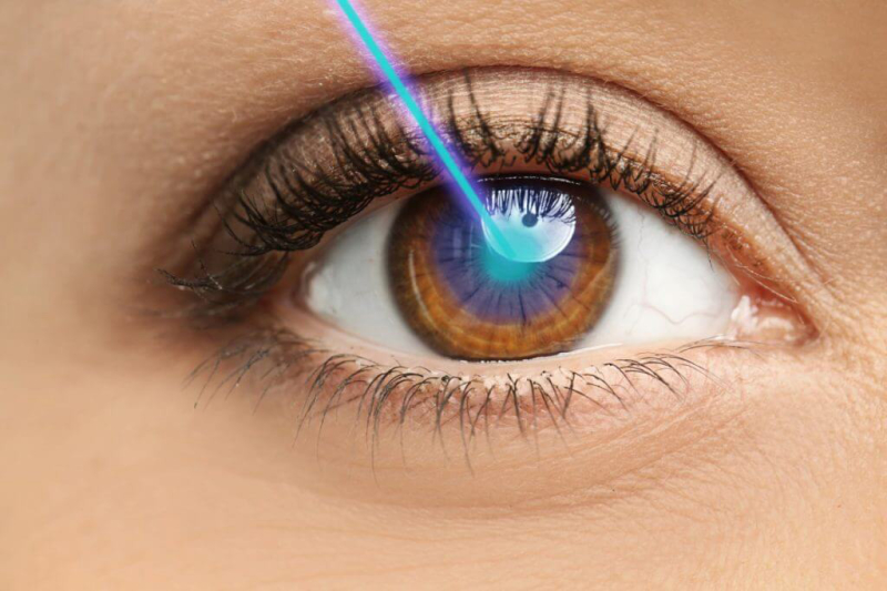 Cirurgia a laser para tratamento de doenças oculares