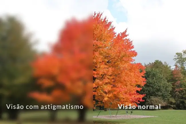Síntomas do Astigmatismo Mais Comuns Síntomas do Astigmatismo Mais Comuns