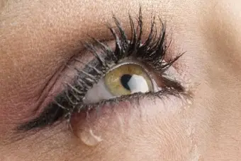 Olhos lacrimejantes Olhos lacrimejantes