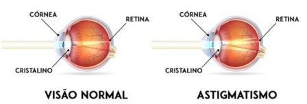 Como sei se tenho astigmatismo?