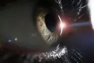 Degeneração macular nos olhos