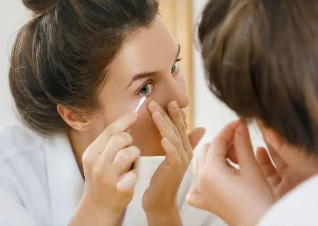 O que é a blefarite e como fazer uma correta higiene palpebral O que é a blefarite e como fazer uma correta higiene palpebral