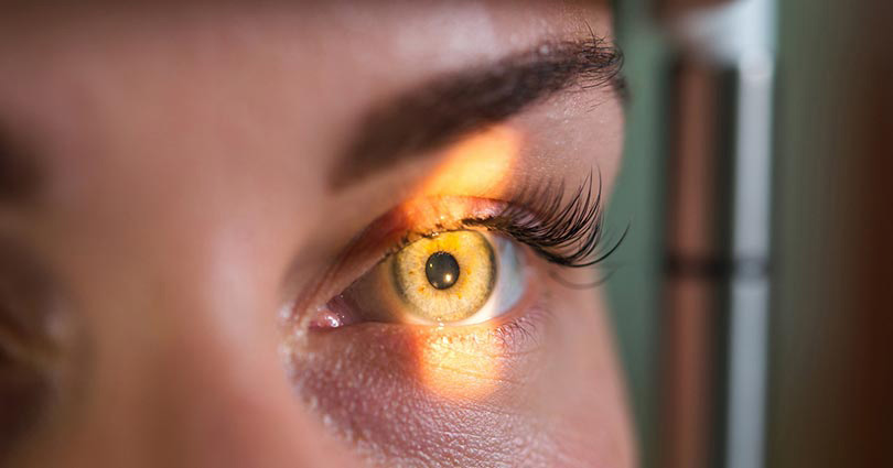 Doenças oculares raras: descubre algumas