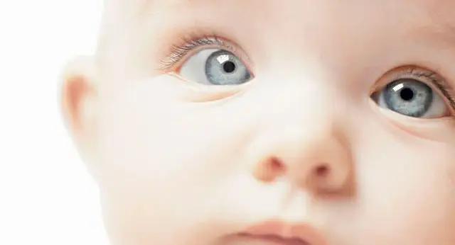 Estrabismo Infantil: Causas, Síntomas e Tratamientos Estrabismo Infantil: Causas, Síntomas e Tratamientos