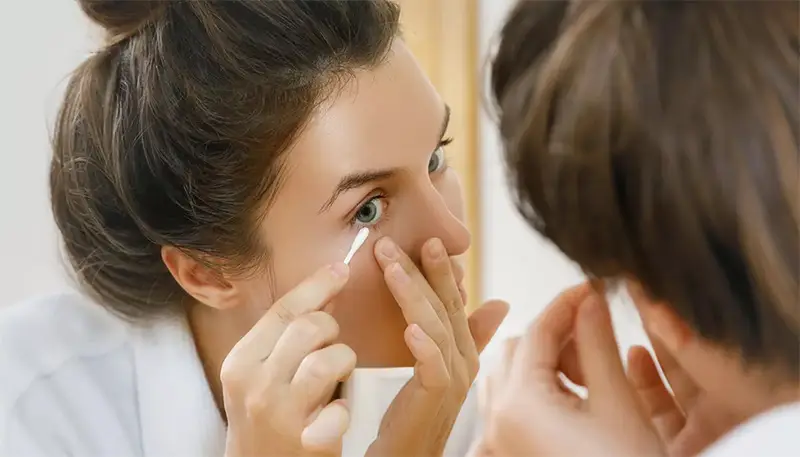 O que é a blefarite e como fazer uma correta higiene palpebral O que é a blefarite e como fazer uma correta higiene palpebral