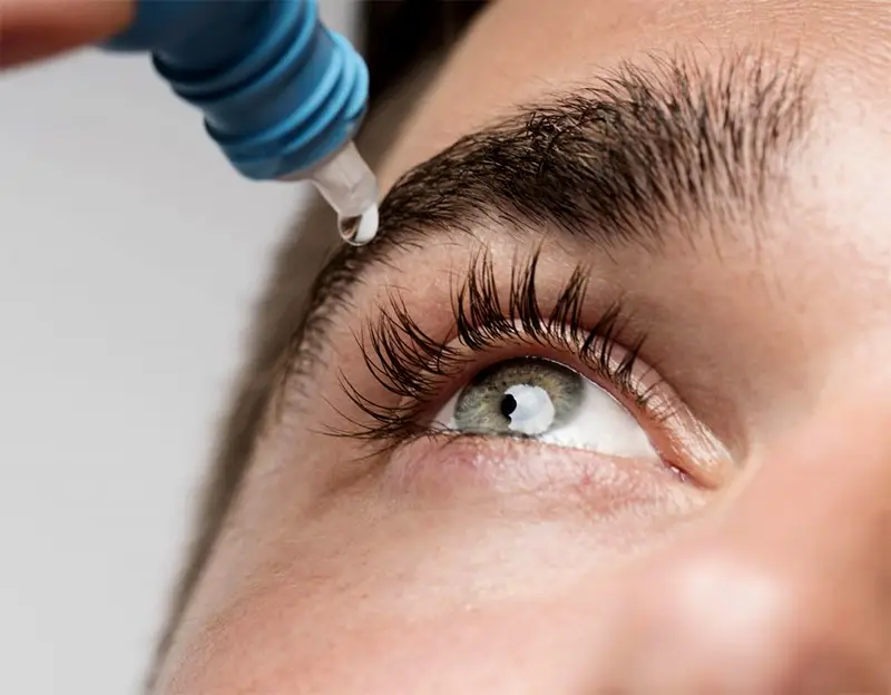 Utilização de lágrimas artificiais no canal lacrimal Utilização de lágrimas artificiais no canal lacrimal